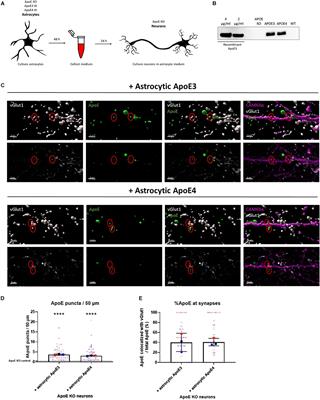 Astrocytic and Neuronal Apolipoprotein E Isoforms Differentially Affect Neuronal Excitability